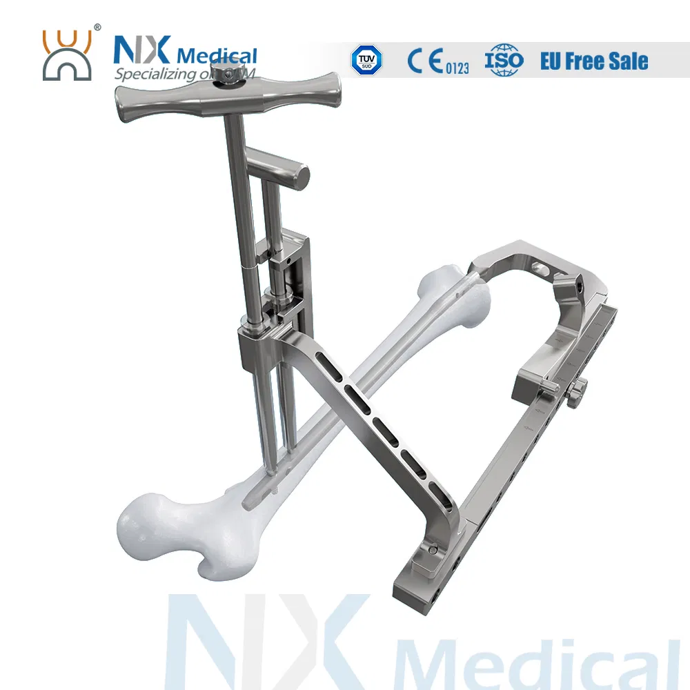 Nx Medical Retrograde Titanium Femoral Intramedullary Interlocking Nail System for Orthopedic Implants