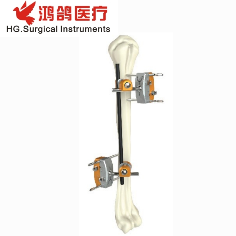 Orthopedic Instrument Humeral Shaft External Fixator Proximal Humerus Fixator Humerus Fixator