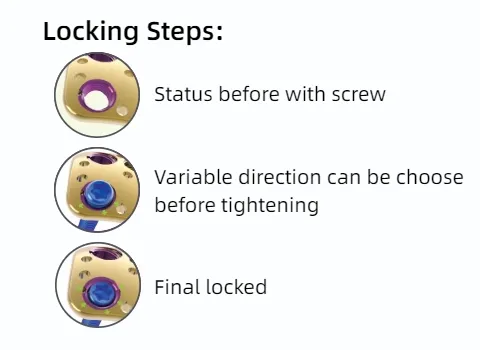 Variable Angle System