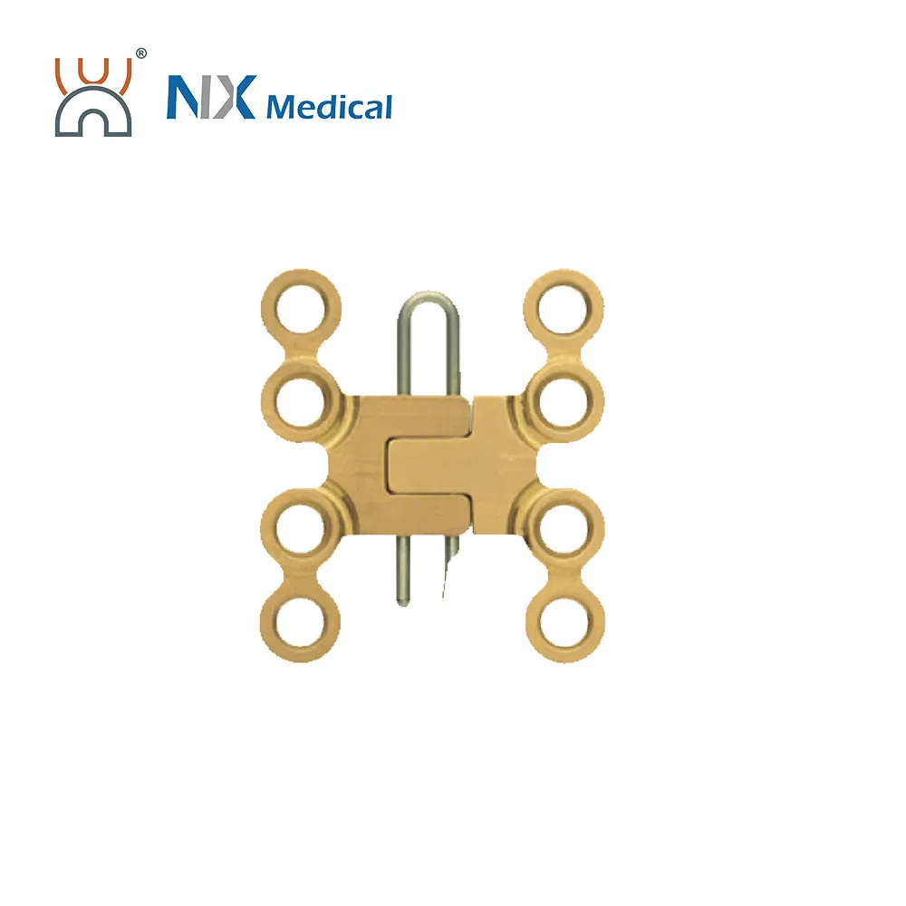 Nx Medical Locking Plates LCP Sternum 2.9mm System Implants for Orthopedic Fixation