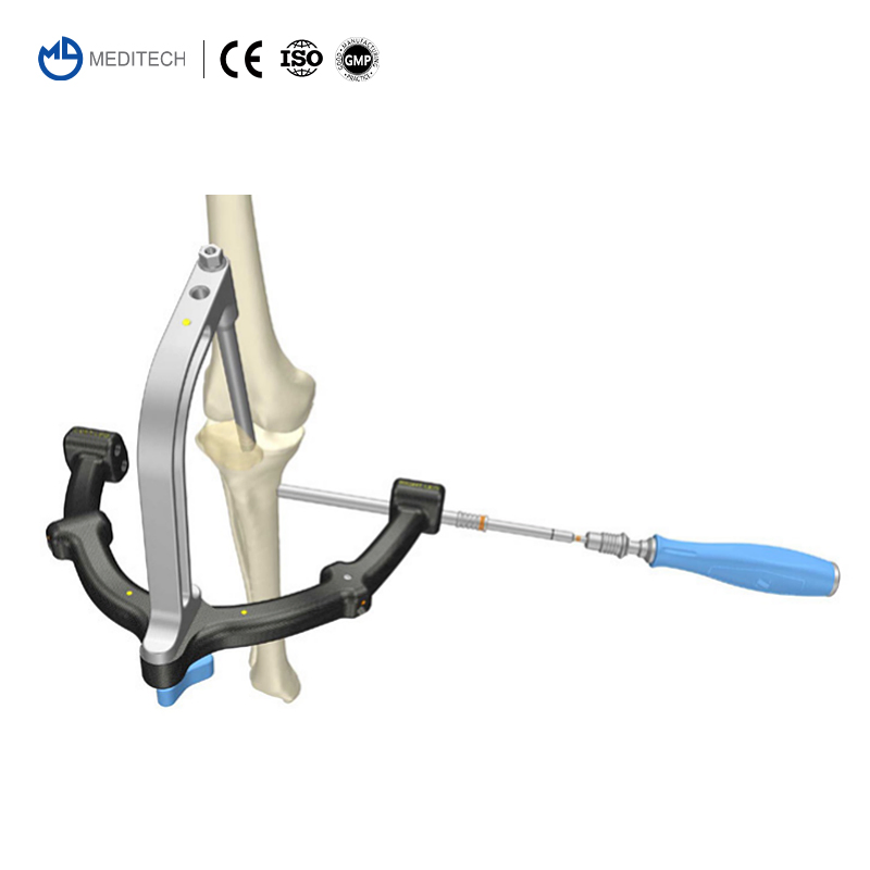 Titanium Orthopedic Surgical Implant Suprapatellar Approach Tibial Intramedullary Nail