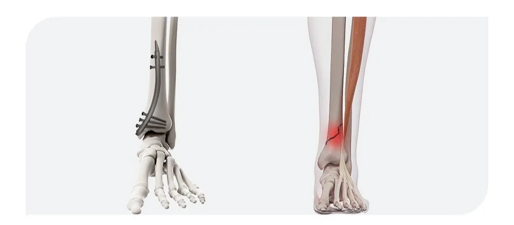 Instrument Function Display