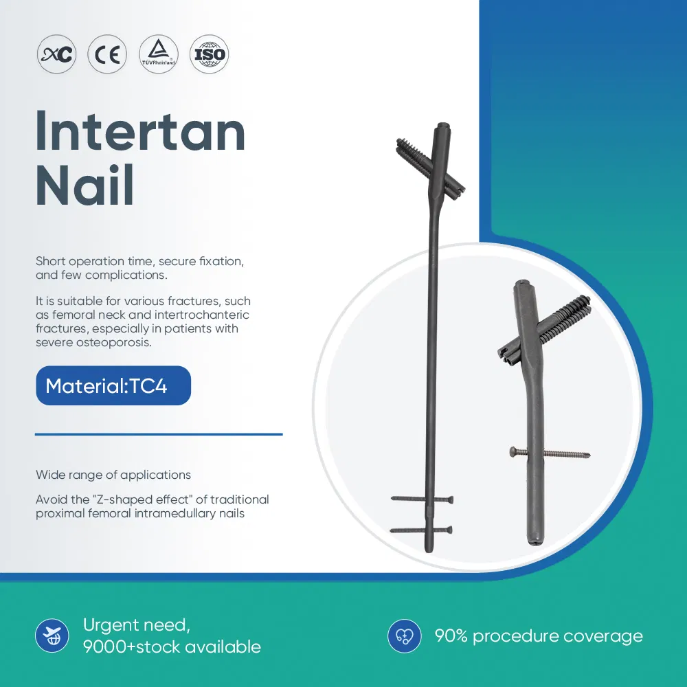 Interlocking Nail System