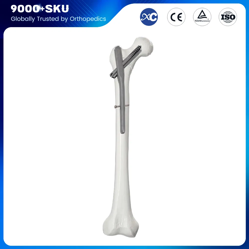 Hot Selling Factory Orthopedic Intramedullary Nails Titanium Intertan Interlocking Nail Surgical Implant