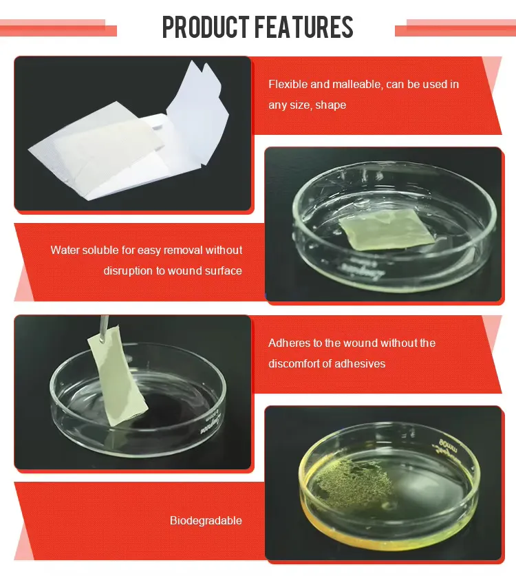 Medical Gauze Application