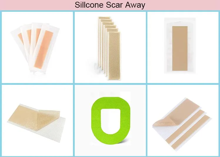 Medical Alginate Dressing 2