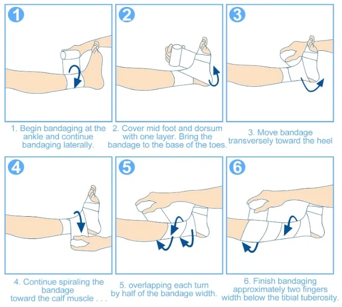 High Elastic Bandage 1