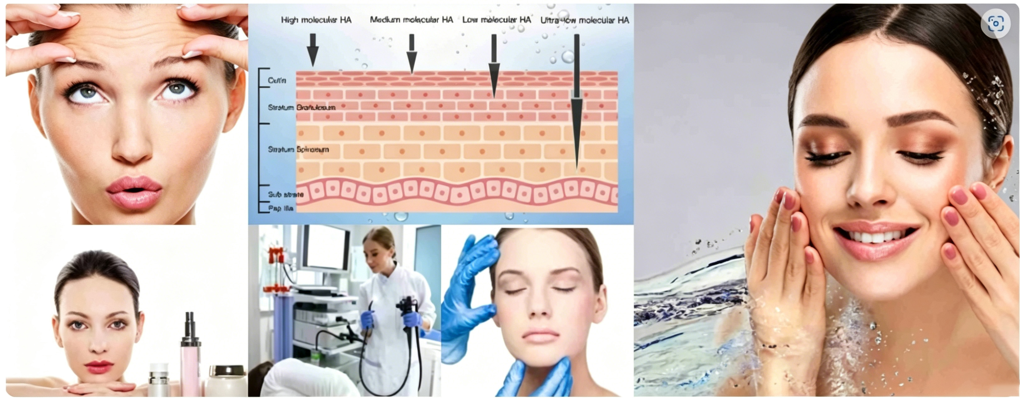 Application of Hyaluronic Acid 2