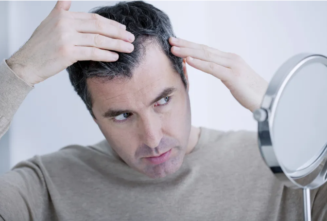 Minoxidil 2
