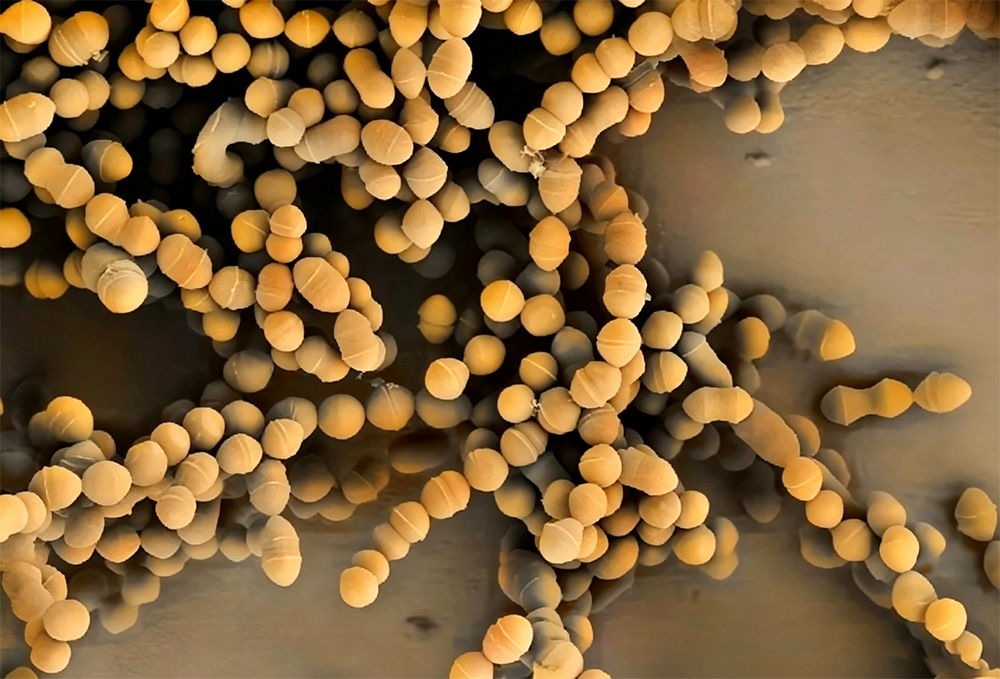streptococcus-thermophilus-2