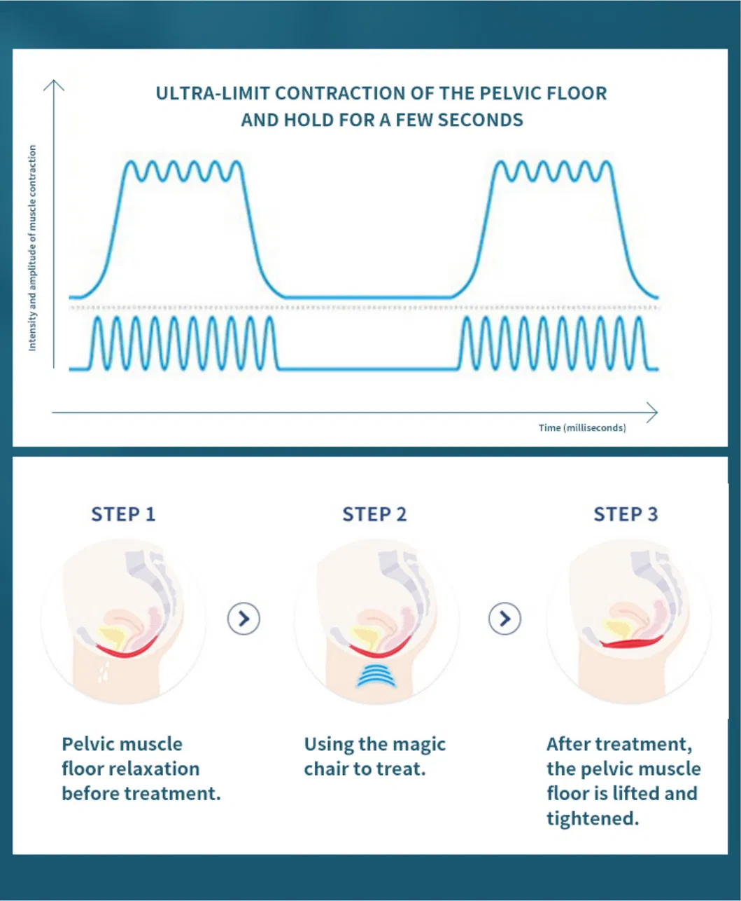 Pelvic Chair Side View