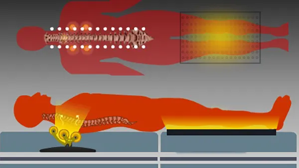 Infrared heating therapy