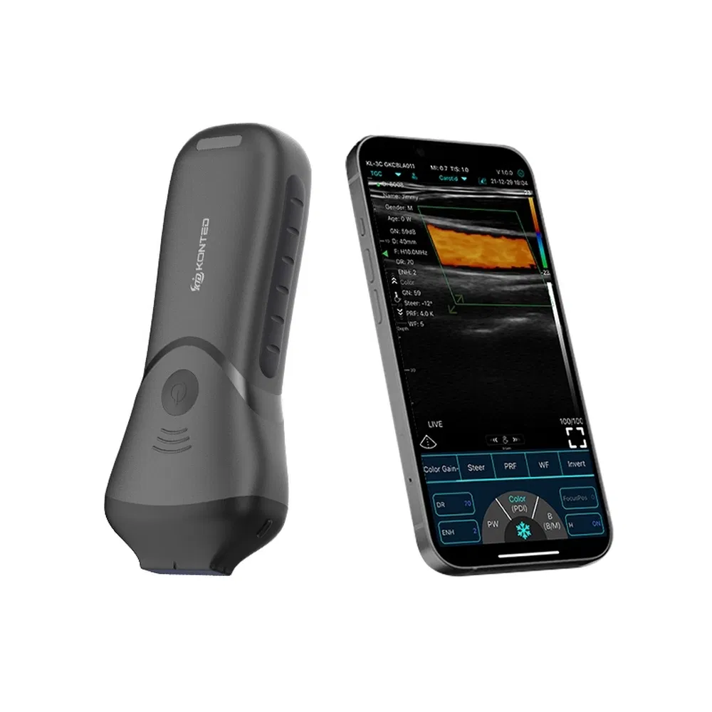 Rechargeable Multi-Frequency Ultrasound Imaging System Handheld Probe for Carotid Artery Studies