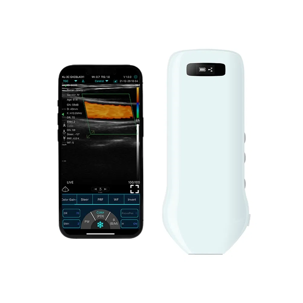 Smartphone-Compatible Handheld Ultrasound Probe C10CS Device for Carotid Artery Imaging