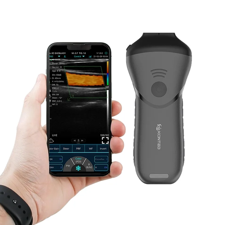 Ultrasound Handheld Probe View