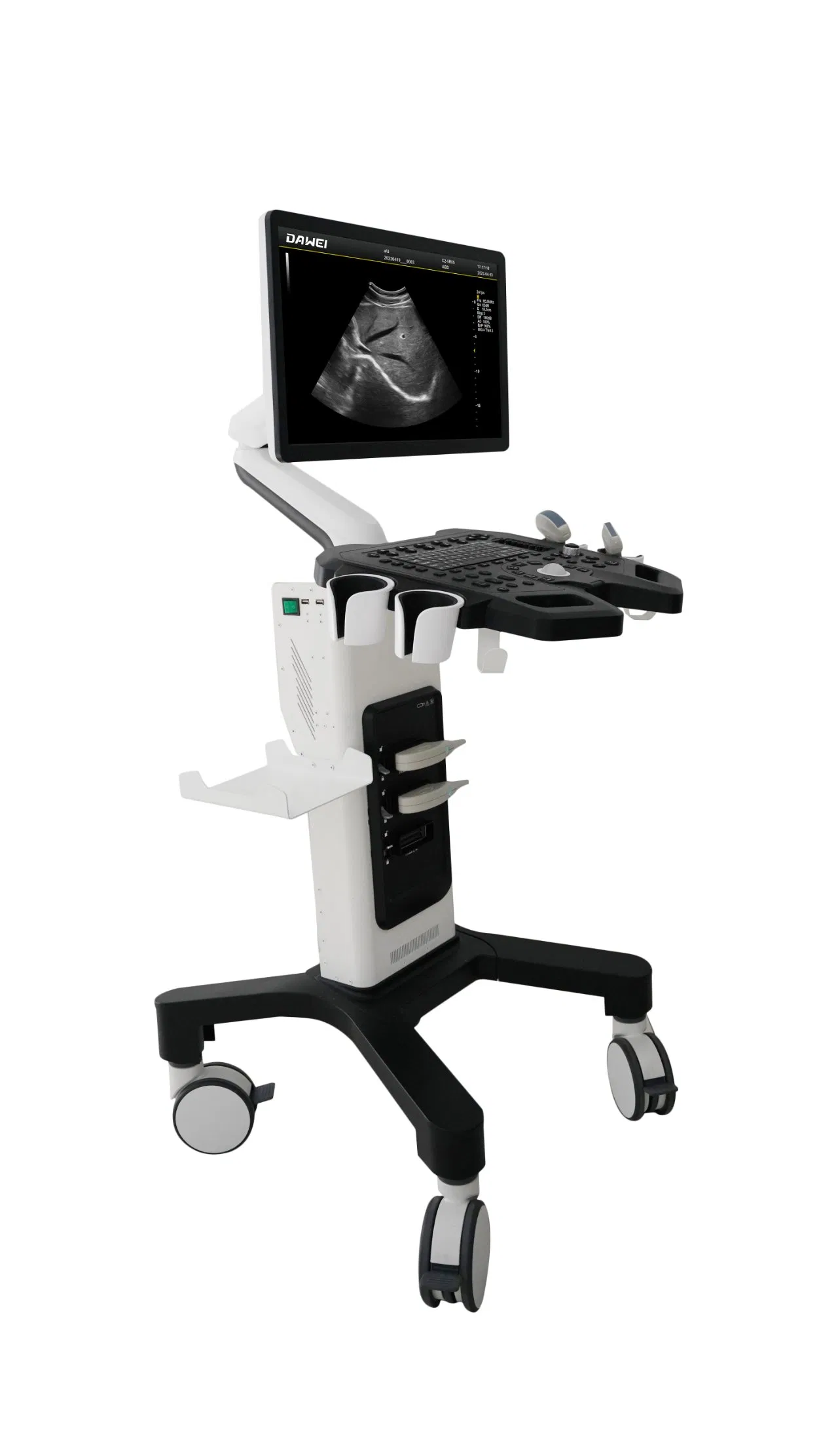Mobile Cart Trolley 2D Carotid Artery Vascular Doppler Ultrasound Scanner