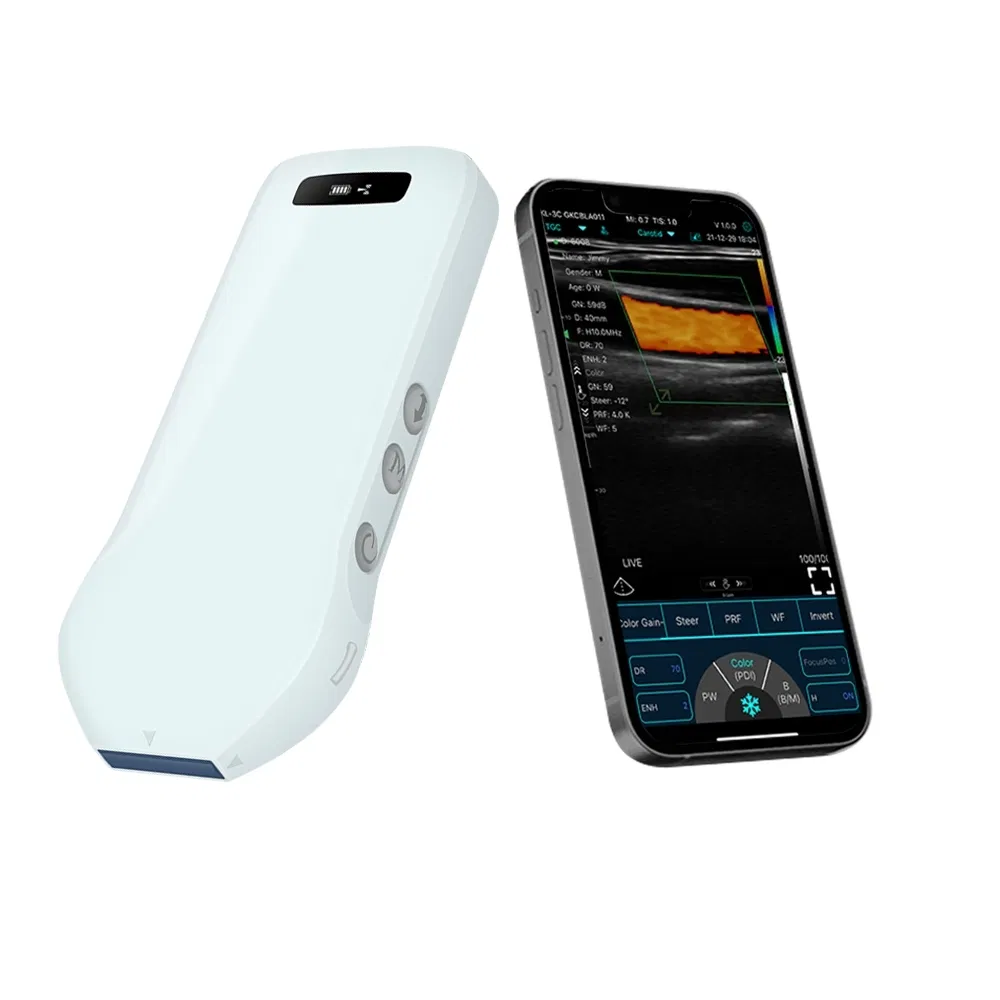 Smartphone-Compatible Handheld Ultrasound Probe C10CS Device for Carotid Artery Imaging