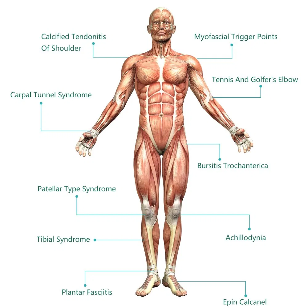Medical Grade Electrotherapy Device for Chronic Pain Relief Compact Electrical Stimulation Device