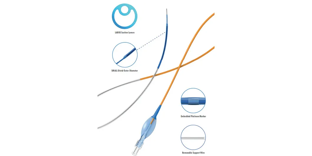 Advanced Thrombus Extraction Catheter