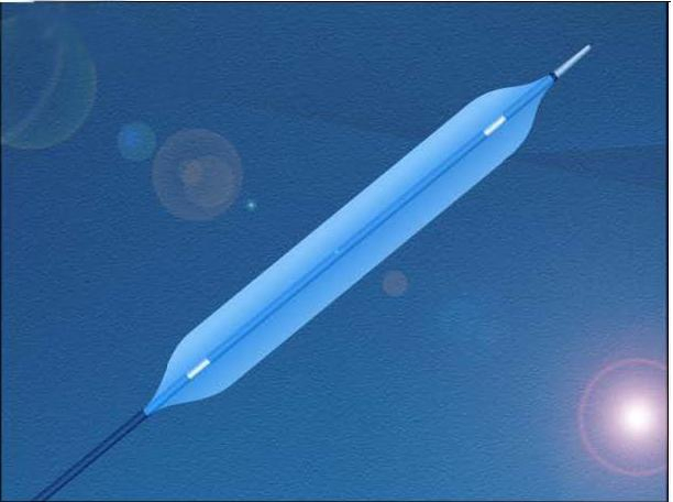 Disposable Ptca Balloon Dilatation Catheter