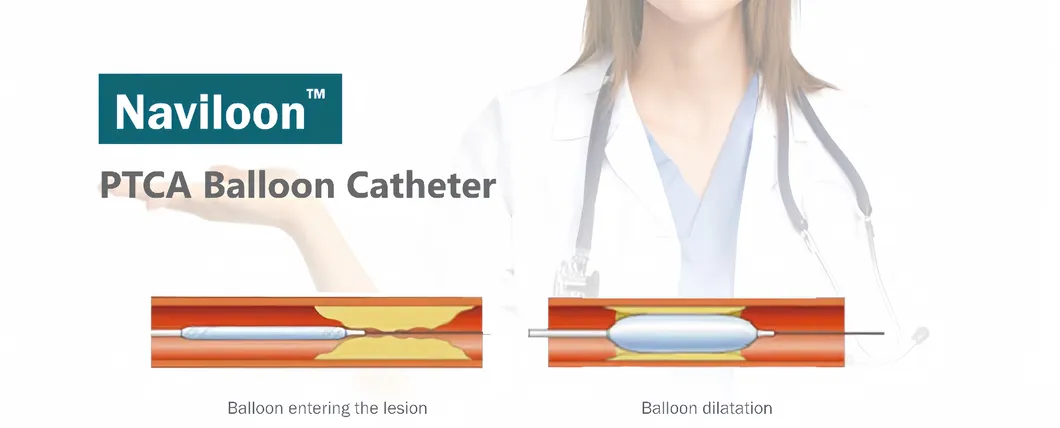 Medical Cardiology Interventional