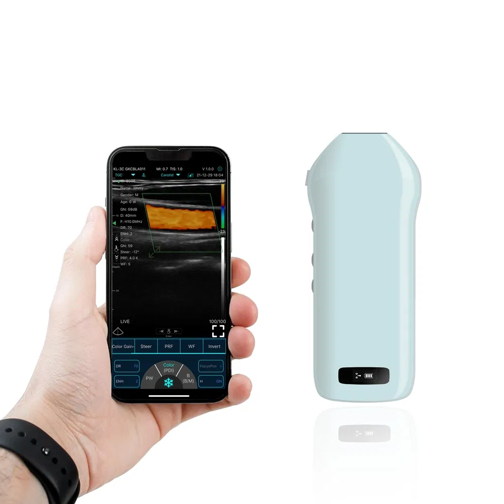 Smartphone-Compatible Handheld Ultrasound Probe C10CS Device for Carotid Artery Imaging