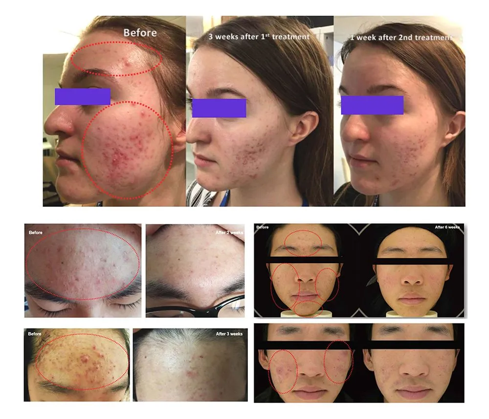 Before and After Results