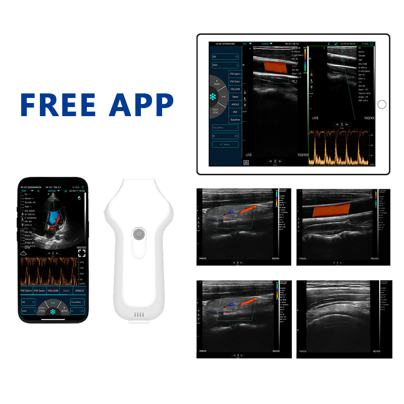 Lightweight C10UC Wireless Animal Ultrasound Probe with Long - Lasting Battery for Extended Field Use