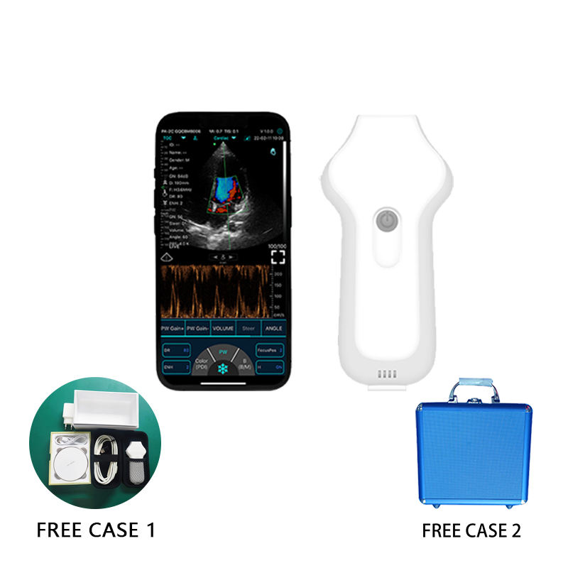 Lightweight C10UC Wireless Animal Ultrasound Probe with Long - Lasting Battery for Extended Field Use