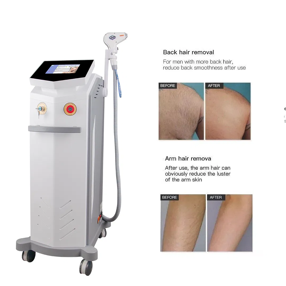 Professional Hair Removal Machine for Aesthetic Salon Use