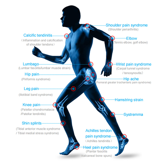 Physiotherapy Physical Rehabilitation Focal Focus Focused Shockwave Electromagnetic Ondas De Choque Shock Wave Therapy Eswt ED Erectile Dysfunction Machine