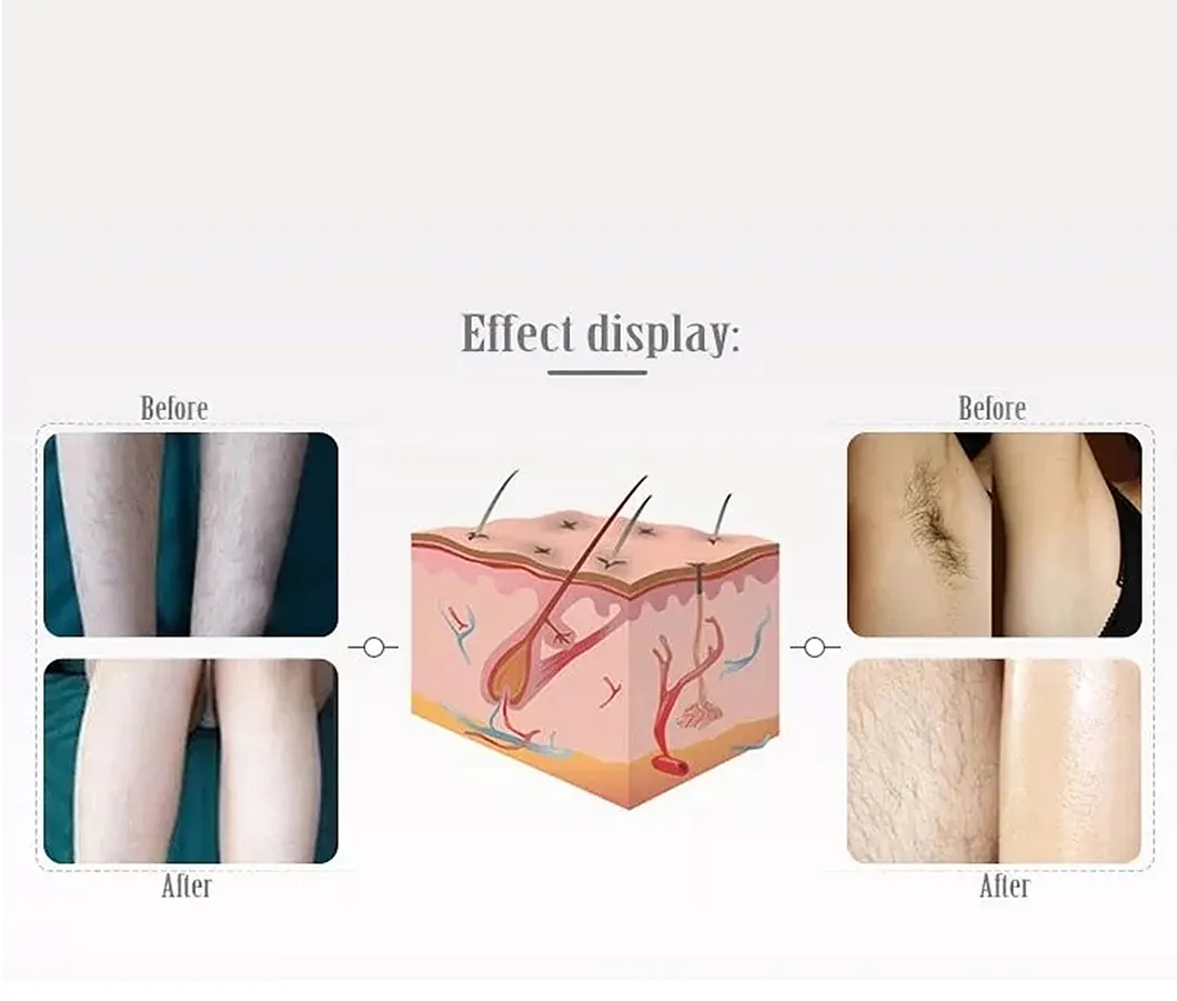 Laser Working Theory