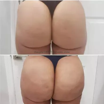 Before and After Results