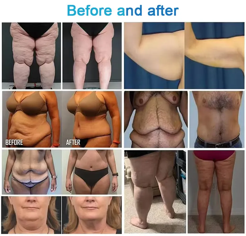 Treatment Result