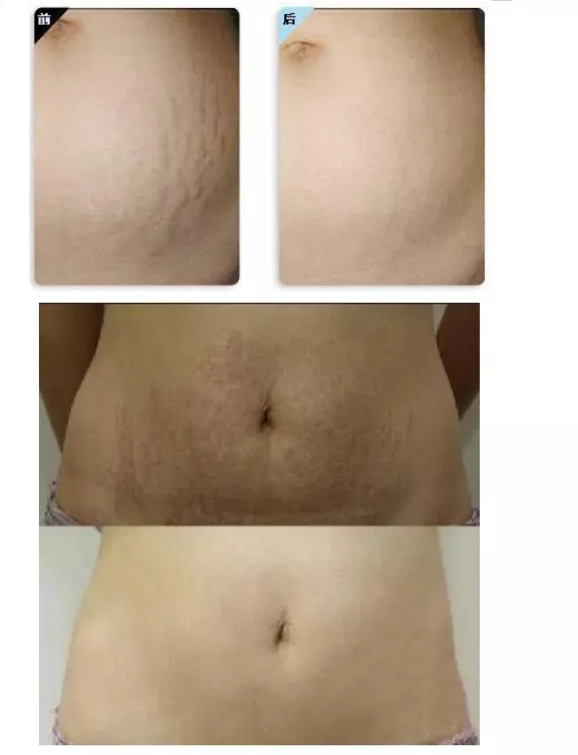 Before and After 4