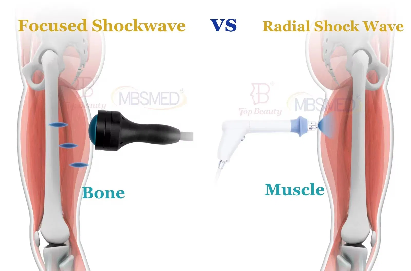 Eswt Shock Wave Machine Focused Therapy ED Erectile Pain Relief Dysfunction Physiothera Device