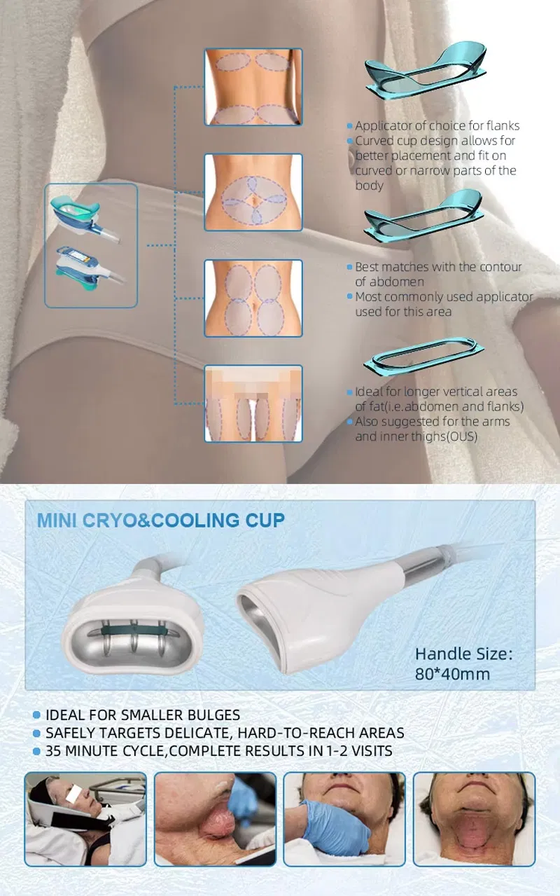 Changeable Handle Cups