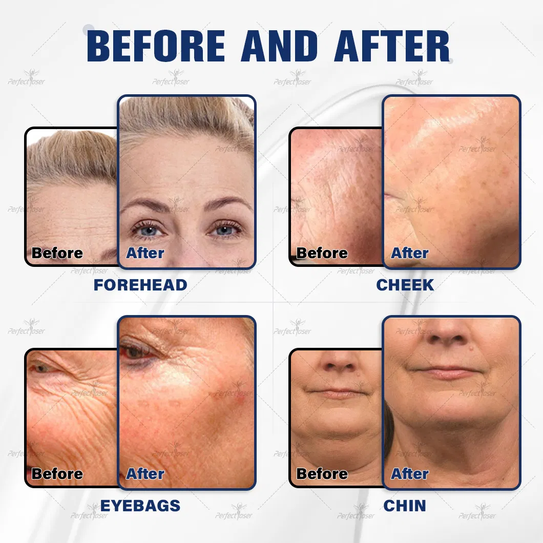Non-invasive treatment