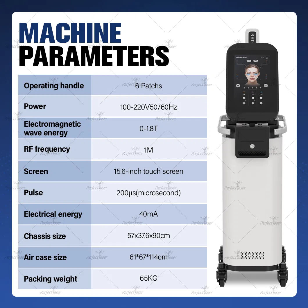 Parameters chart