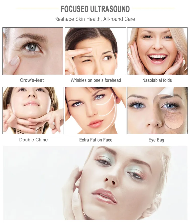 Hifu Results