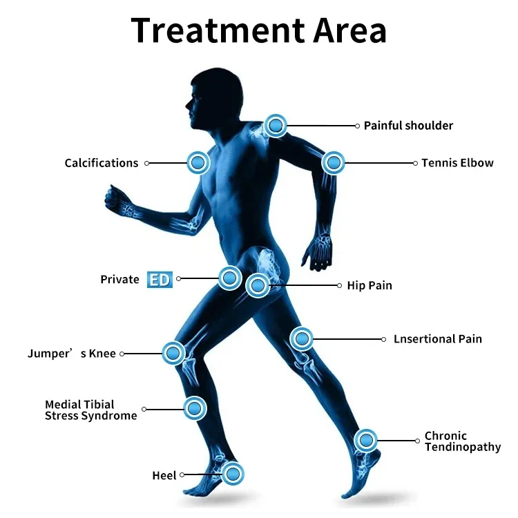 Shockwave Therapy Machine 1