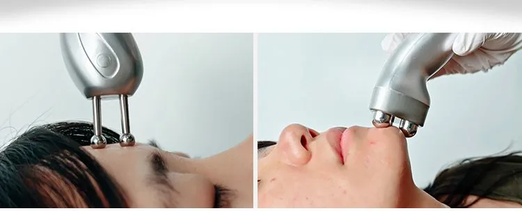 RF Treatment