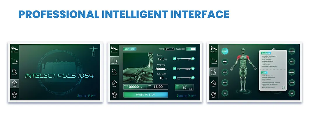 Smart UI Screen