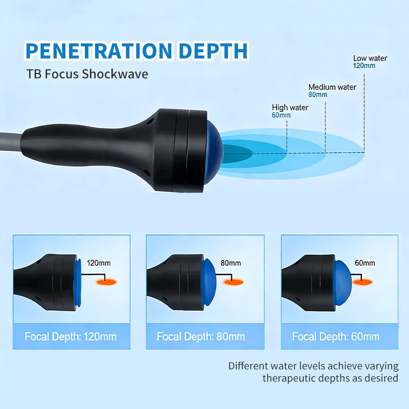 Deepwave High-Energy Focused Shockwave Therapy Machine Chronic Musculoskeletal Pain Relief Plantar Fasciitis Resolution Therapy