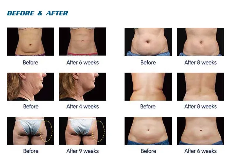 Slimming Results Comparison