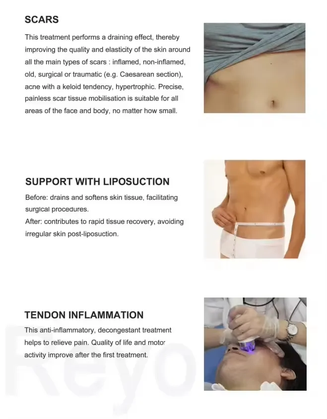 Slimming Machine