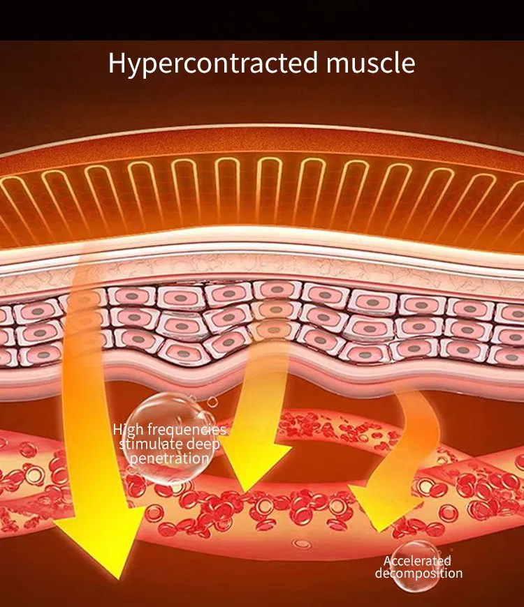 Muscle Stimulation