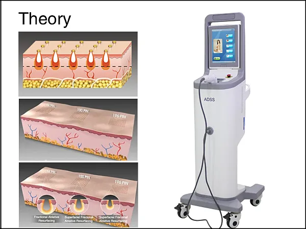 RF Skin Treatment Principle