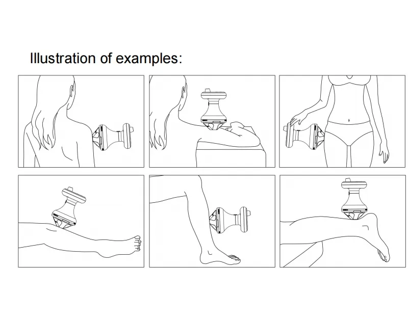 Operation Handle