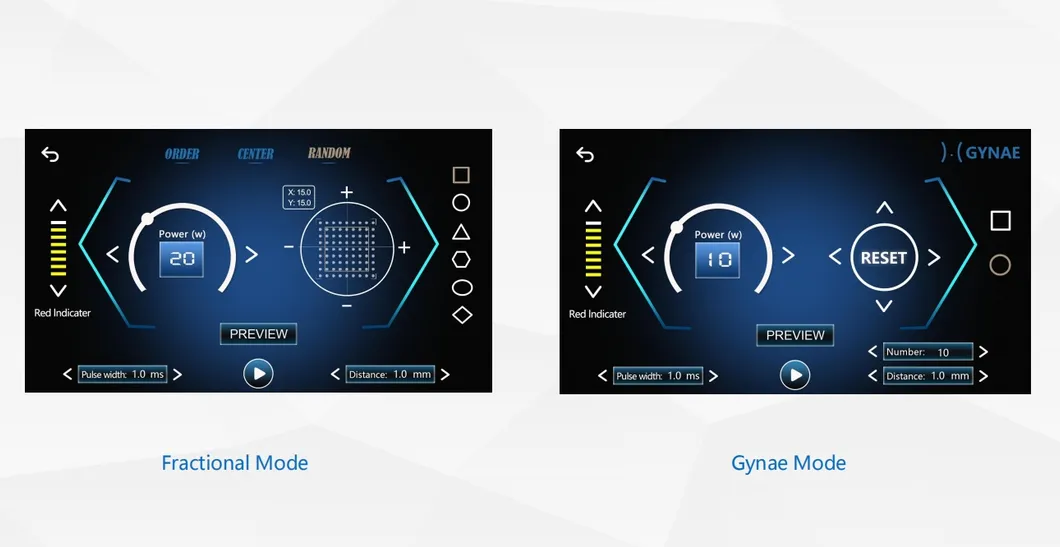 Software UI 1